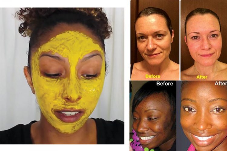 Turmeric facial mask