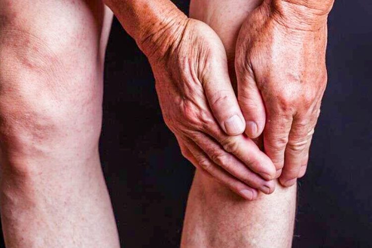 Osteoarthritis – Symptoms, Causes, Flare-Up Triggers & Treatment Options